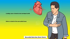 Warning Signs Of A Heart Attack |Heart Attack - Warning Signs