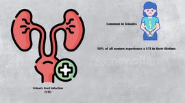 Urinary Tract Infection (UTI) - Causes, Risk Factors, Signs & Symptoms, Diagnosis, And Treatment