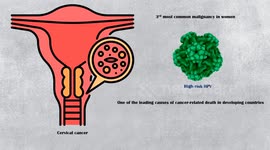 Pap Smear Test (Pap Test) - Indications & How It Is Being Done - Everything You Need To Know