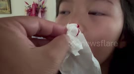 Children suffer nose bleeds as killer air pollution chokes Thailand