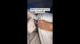 What is all this dirt in her toenails?