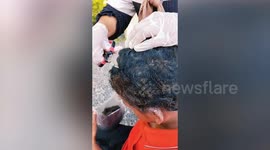 Boy's head infested with lice shaven by rescuers