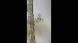 Rotifer Under a Microscope