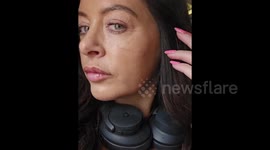 Beautician spent £1.2k on eyelid surgery so she can do eyeliner properly
