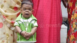 Indian man, 25, is only 20 inches tall and looks like a two-year-old