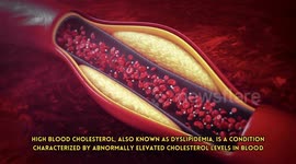 These Signs Tell You That You Have High Blood Cholesterol |Warning Signs Of High Blood Cholesterol