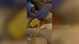 Baby born 12 weeks early - weighing less than a loaf of bread - now thriving