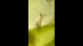 Microscopic Rotifer Spins Cilia