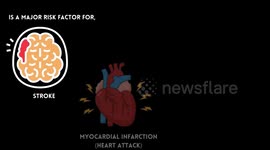Do You Have High Blood Pressure? Avoid These Foods At All Costs |Worst Foods For High Blood Pressure