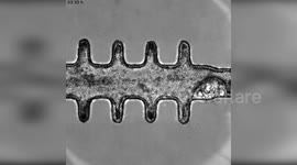 Switzerland: “mini-colons” have revolutionized the study of tumor development