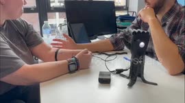 Woman operates bionic hand for the first time - before it's even put on her arm