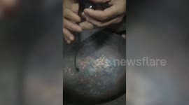 India: Customs officials seize gold worth $84,629 from passenger's rectum