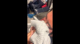 Sister gets eyelid stuck in zipper
