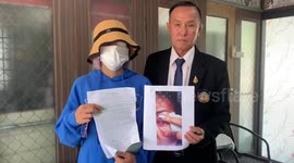 Model goes BLIND and has eyeball removed after eyelash extension blunder at clinic