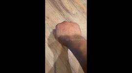 Got bit by an ant!  My hand is swelling!  #ant #bite #swollen #poison