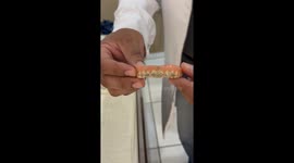 Dentist hilariously breaks down at sight of dentures with braces