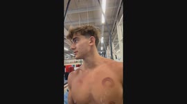 Gymnastics Routine Interrupted By Broken Ring