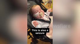 Tot is the only child in the world with rare condition and has 34 seizures a day