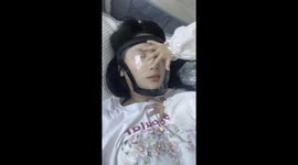Mother wears face shield to protect against baby's scratches