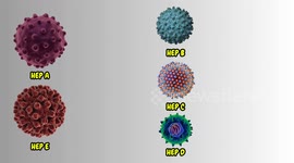 Hepatitis A Infection - Signs & Symptoms, Risk Factors, Virology, Diagnosis, And Treatment
