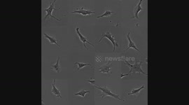 A montage of 16 different Ewing's sarcoma cancer cells divide.