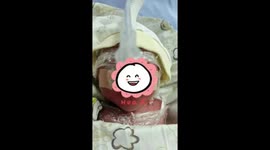 820-gram infant born mid-flight in China