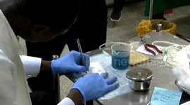 Nigeria: Nigeria ramps up response to mpox outbreak