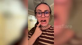 Woman's dental implants snap in half while eating a burger