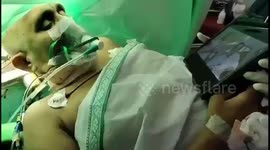 Patient watches comedy movie while having brain surgery