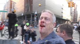 Israel supporter bloodied after clashing with pro-Palestine group in New York