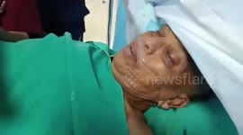 India: Successful awake brain surgery performed in southern India while elderly woman listens to melodies