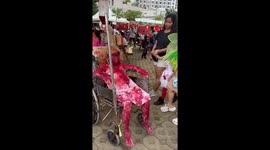 Brother and sister dress as burn victims with extreme Halloween outfits