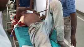 Worker impaled by iron rod undergoes emergency surgery as doctors use machine to cut through rod in central India