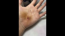 Halloween wound made from makeup looks too realistic for comfort