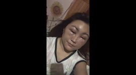 Woman's face is swollen after botched hair dye treatment at salon