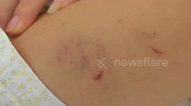 Dog owner allegedly bites pregnant woman to 'protect her dogs'