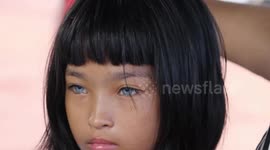 Blue-eyed Asian twins with rare condition leaving them deaf need hearing aids
