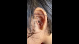 Satisfying moment mother plucks a tick from daughter's ear