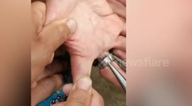 Firefighters rescue 80-year-old woman by removing seven rings from swollen fingers