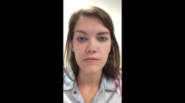 Bells Palsy Sufferer Attempts to Blink
