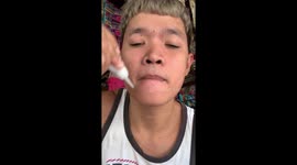 Man struggles to open mouth after applying super glue in Taytay, Rizal, Philippines