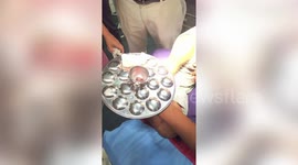 India: 3-year-old gets finger stuck in cooking utensil, rescued