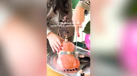 Woman marks birthday and foot surgery by slicing bunion off a foot-shaped cake