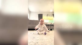 Baby overcomes cleft lip and says