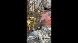 Trimmed Tree Branch Hooked In Man's Face