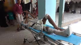 Yemen: Yemen’s hospitals in crisis after U.S. airstrikes leave dozens wounded