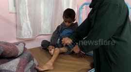 Starvation in Gaza: Emaciated child highlights toll of Israel’s blockade