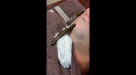 Ancient healing technique goes viral with 19 million views