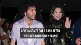 Selena Gomez got a rash after first kiss with Benny Blanco