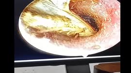 Doctors remove giant butterfly that crawled into man's ear while he was walking on the street